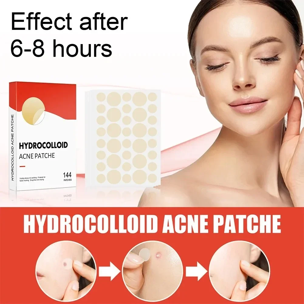 Hydrocolloid Acne Patch Facial Blemishes Pimple Marks Closed Acne Blemishes Cover Acne Pimple Repair Patch Invisible Acne Patch