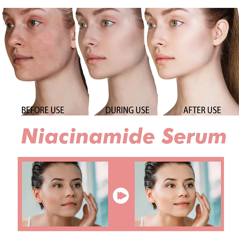 Pêssego 70% niacinamida soro 30ml hidratante evitar secura óleo essencial facial aumentando a elasticidade suave suavizar cuidados com a pele