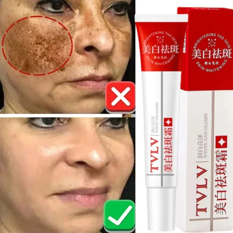 Whitening Freckle Cream Melasma Dark Spots Pigmentation Removal Product Fade Stain Melanin Fast Repair Brighten Korean Skin Care