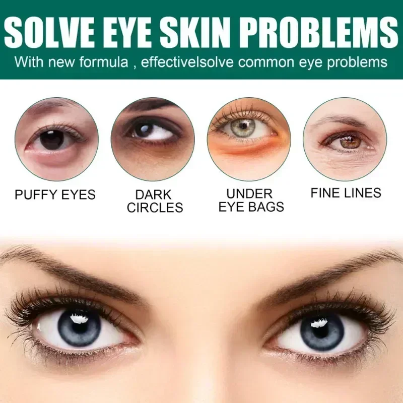 Crema para los ojos con arrugas de 7 días, antiojeras, hinchazón, líneas finas, blanqueamiento, cuidado coreano de la piel, novedad de 2023