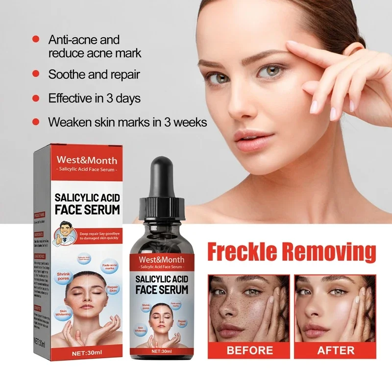 Nicotinamida que atenúa las manchas, esencia Facial, ácido salicílico, reduce los poros, eliminación de pecas, hidrata, productos para el cuidado de la piel 2024