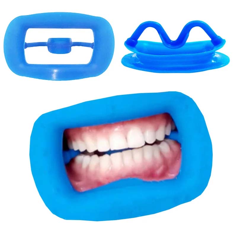 NIGF Dental Soft Silicon 3D Lip Cheek Retractor Mundöffner Wange Erweitern Dental Kieferorthopädische Verbrauchsmaterialien 4 Farben erhältlich