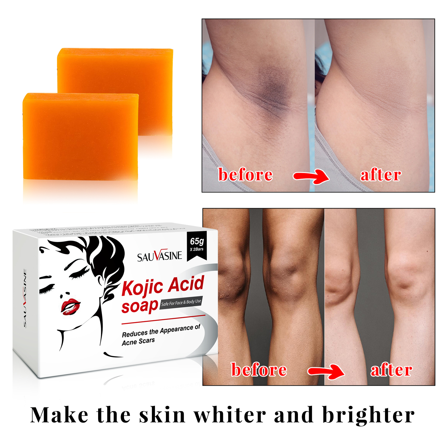 Kojic Acid สบู่ล้างหน้าทำความสะอาดได้อย่างล้ำลึกควบคุมความมันให้ความชุ่มชื้นดูแลผิว X2 65กรัม sabun pencerah