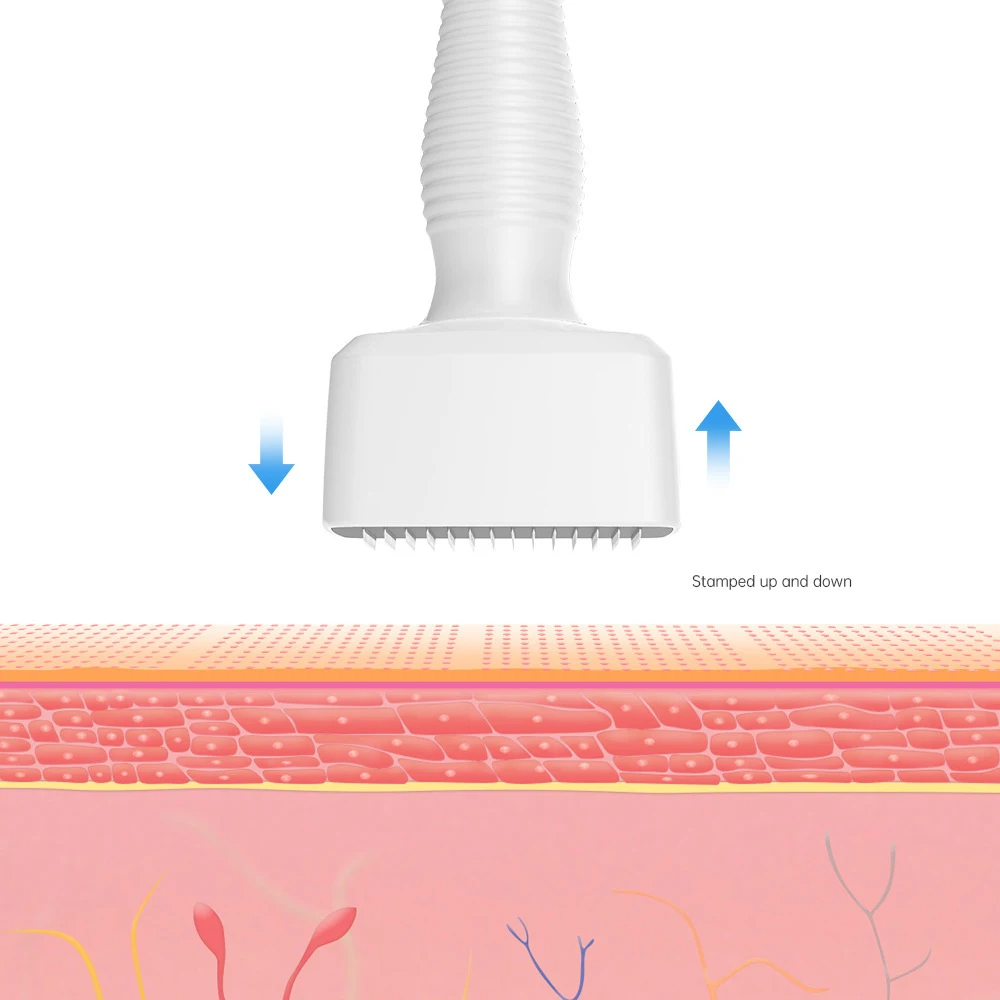 1 STKS 140 naalden Titanium Verstelbare Microneedling