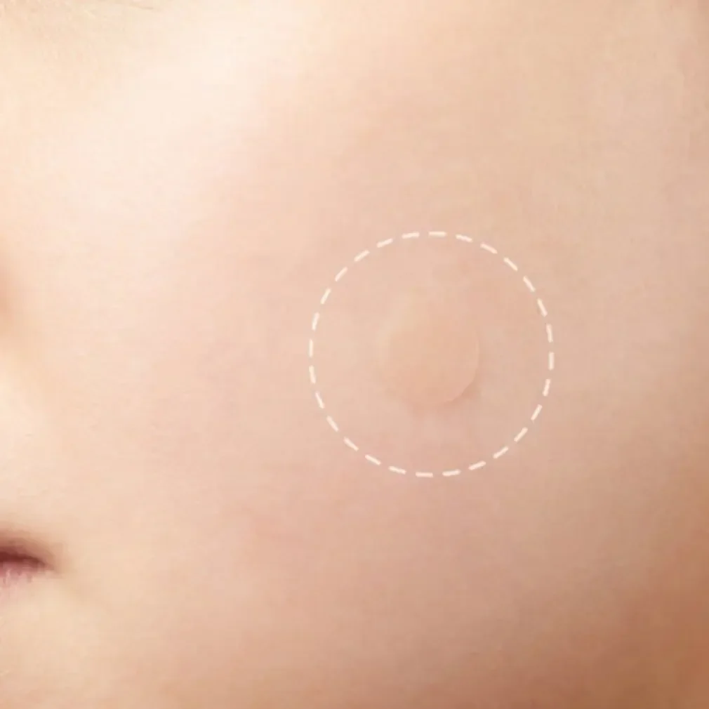 Patch Master per brufoli chiuse 24 cerotti Assorbimento invisibile Segretioni Trucco traspirante Maschera colloidale Adesivi per la cura della bellezza della pelle