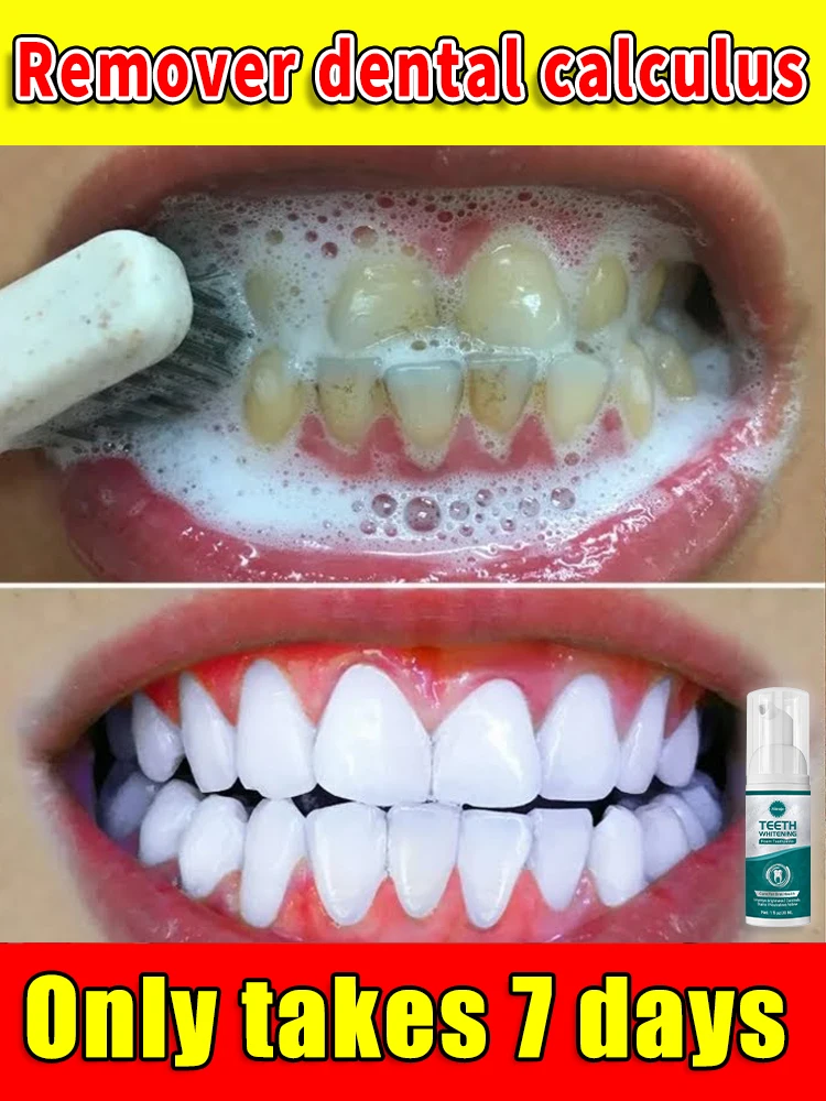 Solve to all dental troubles