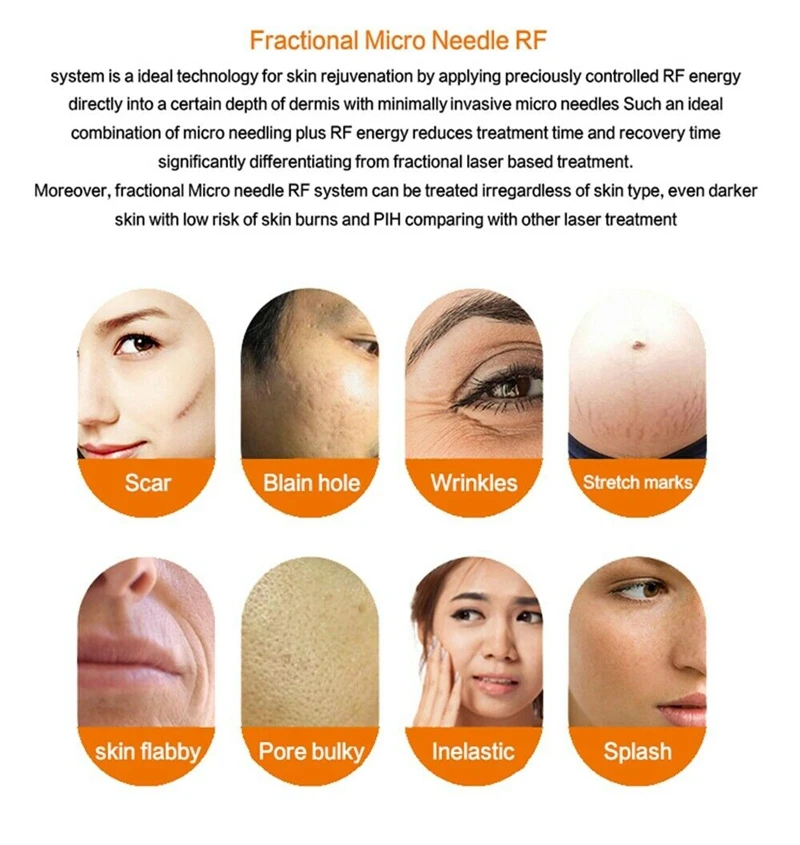 ทิ้ง Microneedle ตลับหมึกทอง 10/25/64 Pins Nano เคล็ดลับสําหรับ Fractional RF เครื่อง Anti Stretch Marks รอยแผลเป็น