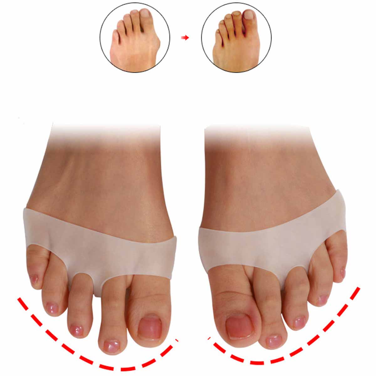 1 Paar Zehen polster weiches Silikon gel Schock Anti Vorfuß polster Zehen trenner Mittelfuß korrektur Fußpflege Schuhe Kissen