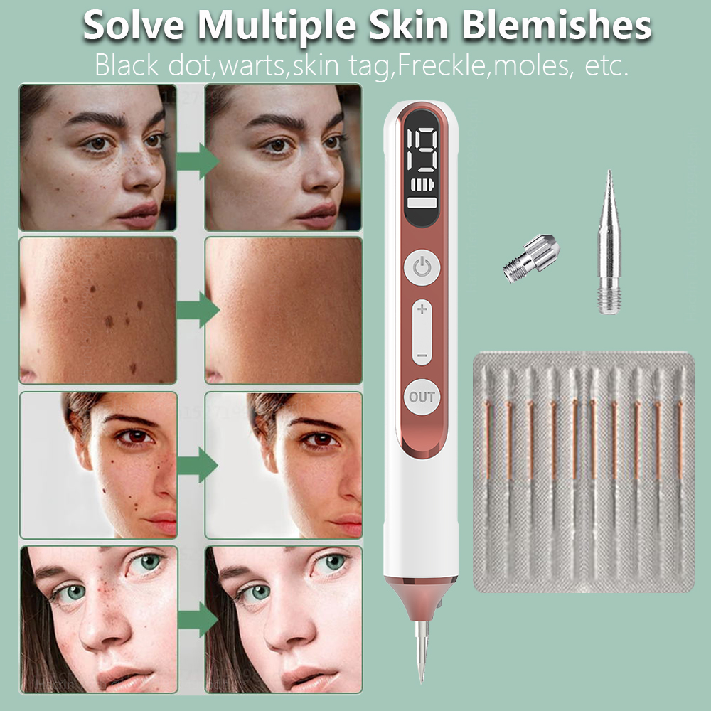 Laser Plasma Stift schwarze Punkte Maulwurf Warze Entferner Stift dunkle Flecken Entferner für Gesicht Körper Makel Entfernung Laser Stift Haut Tag Entfernung