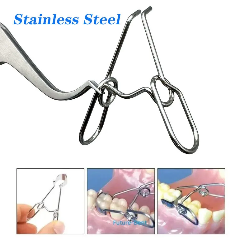 Anel de matriz dentária seccional, matrizes com contornos, faixa de recarga 1.398 1.330, anel de separação de fixação, alicate de cunhas adicionais