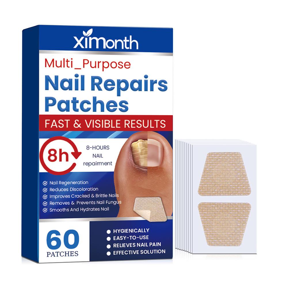 Parches de piezas para uñas de los pies, accesorio de reparación de uñas de los pies, no irritante y transpirable, 60 unidades