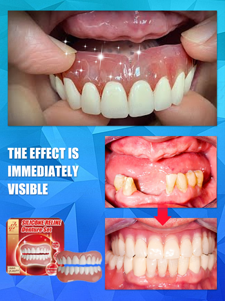 керамические протезы создают свою улыбку естественно!