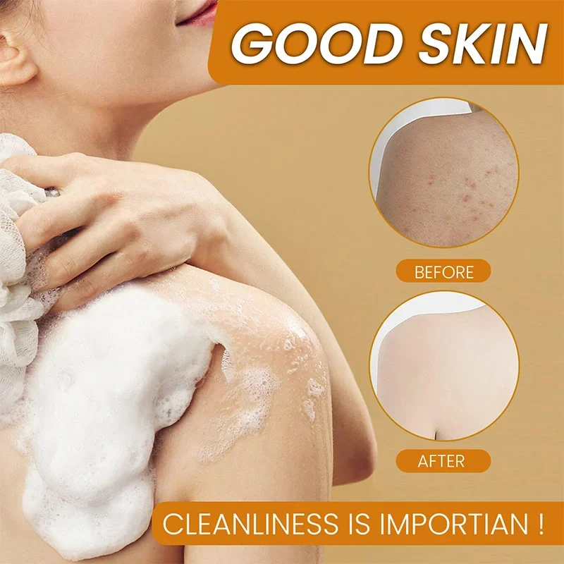 สบู่ขมิ้นทำมือ100กรัมสบู่มะนาวกรดโคจิกสบู่อาบน้ำและสบู่ล้างหน้าให้ความชุ่มชื้นและทำความสะอาดผิวที่มีประสิทธิภาพ