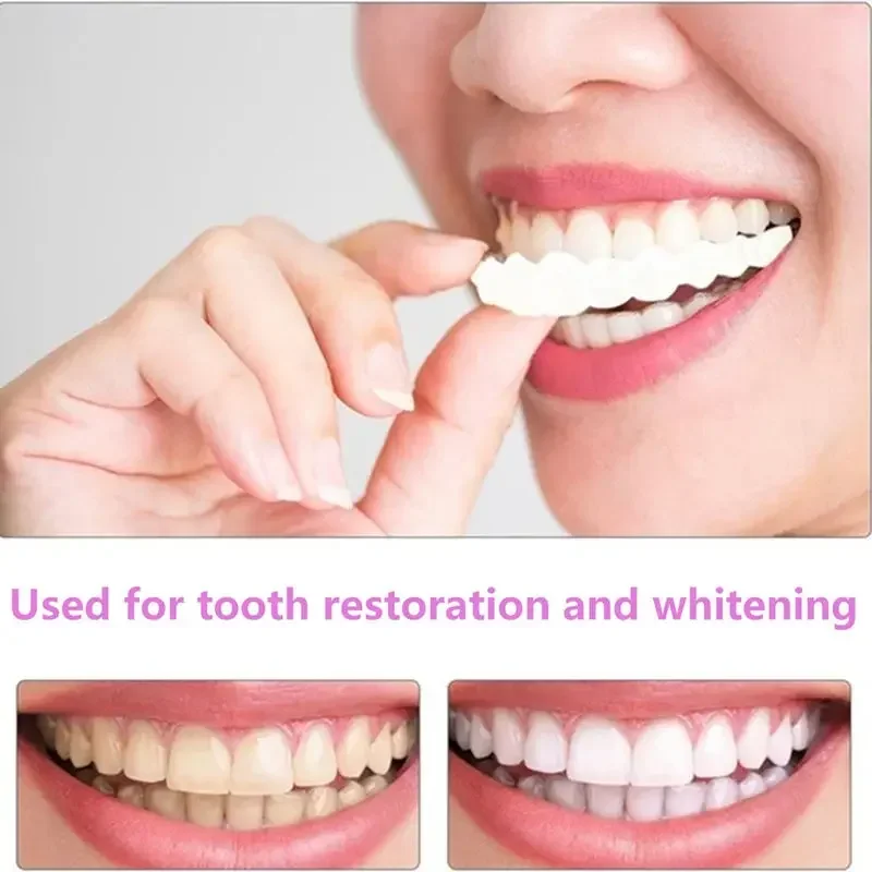 シリコン歯のホワイトニング,偽の歯のカバー,スナップオン,smile veneers,上の美容ツール,化粧歯,送料無料
