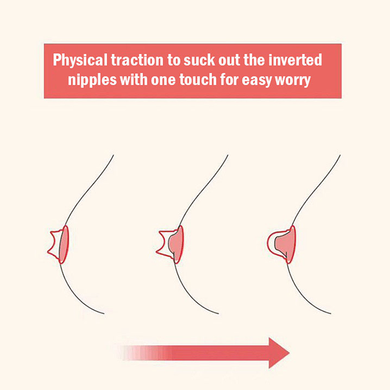 2 Stück Silikon Nippel Korrektor Nippel Schild Sauger für flache invertierte Nippel