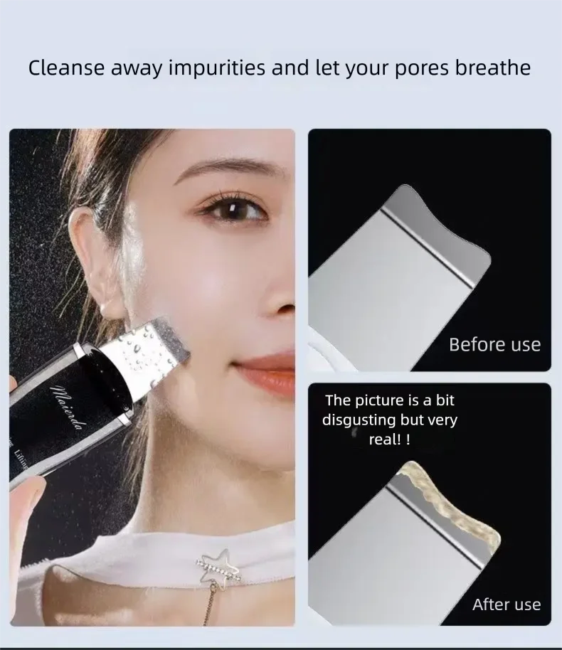 Ultrasonic Skin Scraper Vibration Beauty Device Blackhead Scraper Facial Cleansing Acne Removal Pore Cleansing Lifting Firming