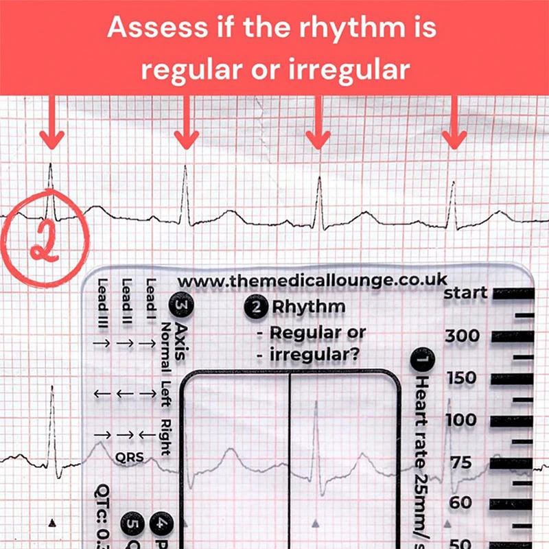 Ecg 7 Step Ruler 7 Step Scale For Ecg Observation Portable Transparent 7step Ruler Measurement Tool Ruler For Ecg Interpretation