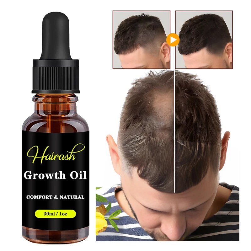 Pegamento para peluca de encaje y tinte de encaje, Spray y removedor para peluca de encaje frontal, banda de fusión, barra de cera para el cabello, pluma de pegamento, Kit de instalación de aceite para crecimiento