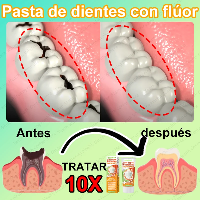 99% ᴅᴇ ᴘᴇʀsᴏɴᴀs, ʀᴇᴄᴏᴍᴘʀᴀ, sᴜᴘᴇʀᴠᴇɴᴛᴀs, ғᴀ́ᴄɪʟ ᴅᴇ ᴜsᴀʀ, ʀᴇᴘᴀʀᴀ ʟᴀ ᴄᴀʀɪᴇs ᴅᴇɴᴛᴀʟ