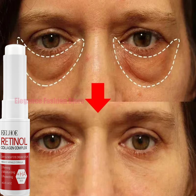 Bolsa de ojos instantánea, crema para eliminar los ojos, partículas antigras, ojeras, hinchazón, decoloración de líneas finas, brillo, belleza coreana, cuidado de los ojos