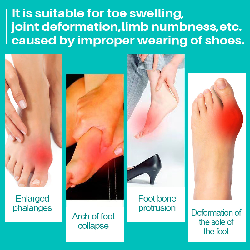 1 шт. Крем для лечения подагры, артрита, боли в пальцах и суставах