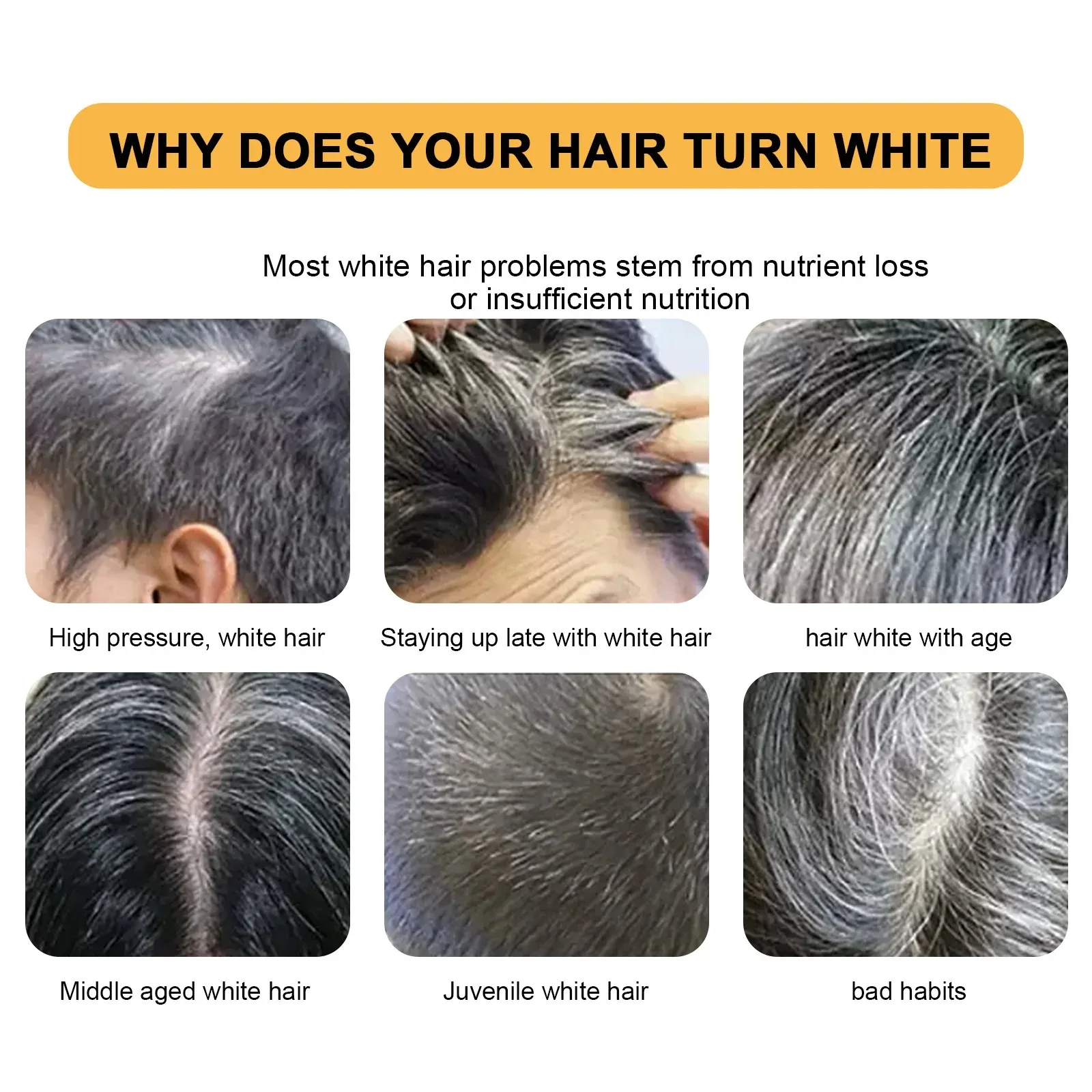 Haarshampoo Zeep Polygonum Multiflorum Zwarte Zeep Wit Haar Reparatie Zeep Haarverzorging Set Voedende Anti Roos Haarverf Zeep