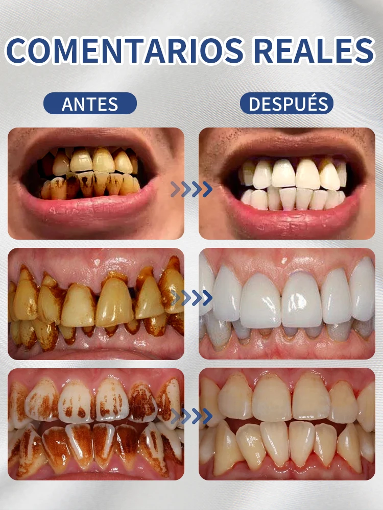 Resolver todos los problemas dentales