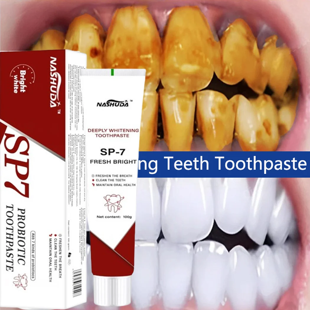 Pasta de dientes probiótica Sp-7, elimina el mal aliento, manchas de dientes amarillas, ilumina el aliento fresco blanco, producto de gestión de la salud Oral, nuevo