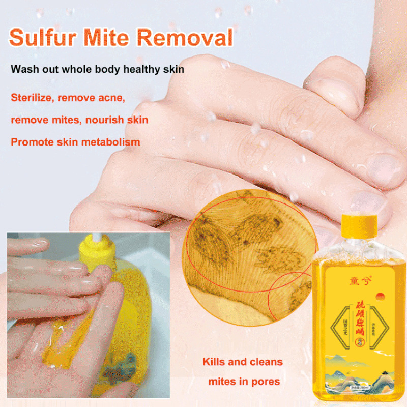 【Cuidado profundo y eliminación de ácaros】Gel de ducha para eliminar ácaros de azufre