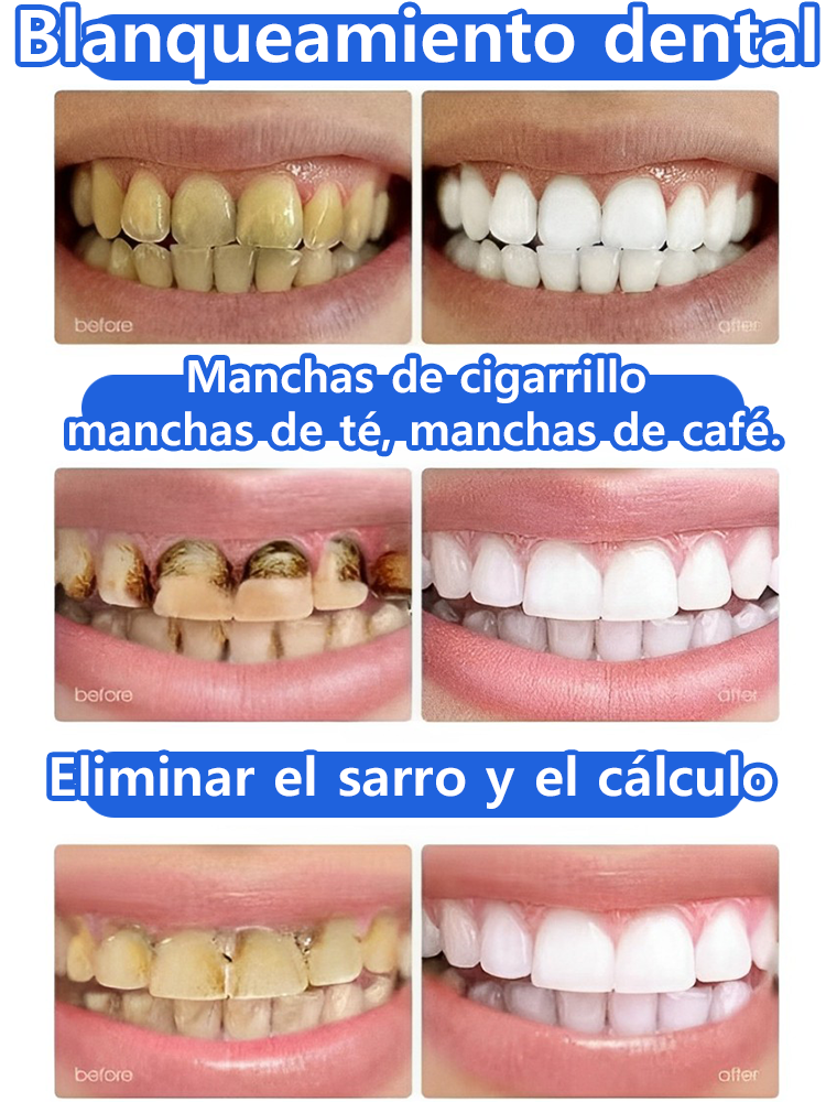Blanqueamiento dental, restauración rápida y natural de las encías, críticas de usuarios abrumadoramente positivas