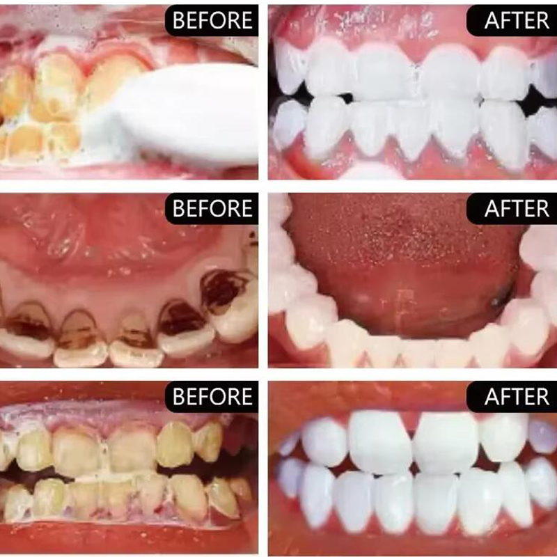 5 Dagen Tanden Whitening Poeder Verwijderen Plaque Vlekken Tandsteen Mondhygiëne Reiniging Verse Slechte Adem Tandverzorgingsproducten
