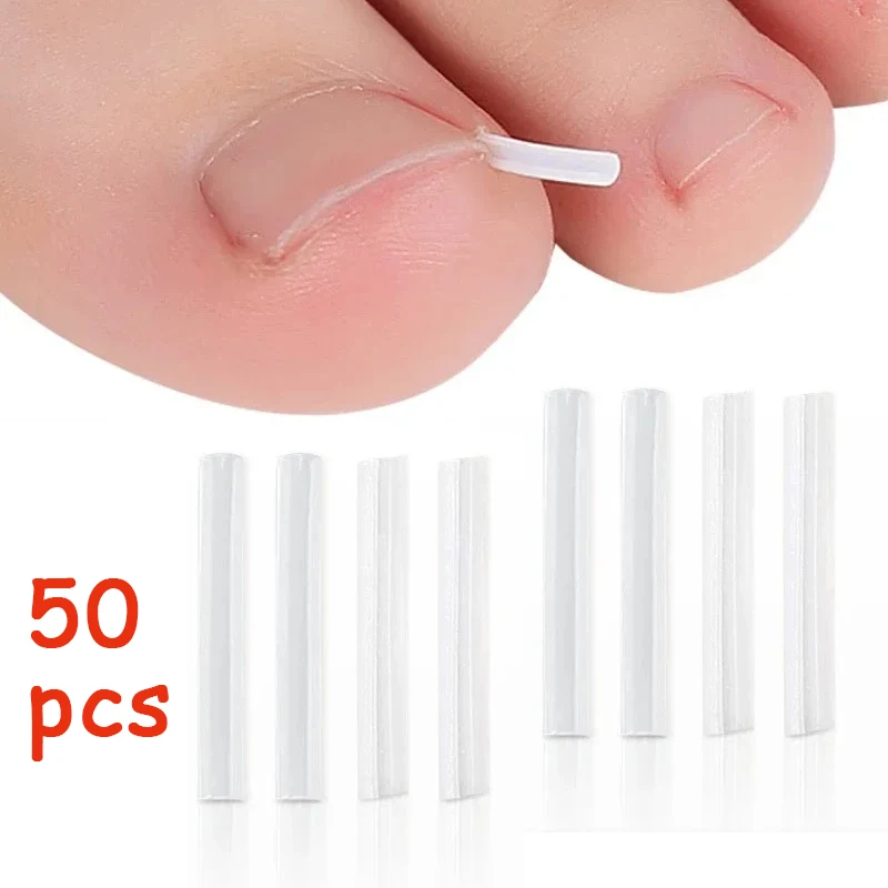 50 pçs ferramenta de correção de unhas encravadas invisível encravadas toe tratamento almofada groove alisamento clipe cinta ferramenta de cuidados com os pés