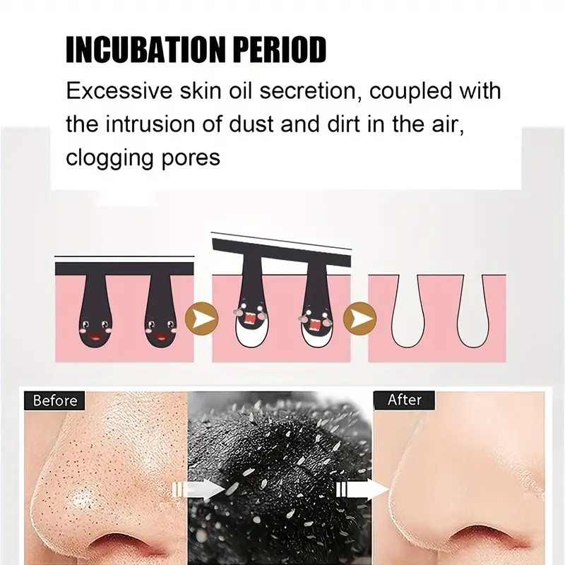 Maschera per la rimozione dei punti neri al carbone di bambù Strisce nasali Punti neri Macchie Maschera per il trattamento dell'acne Adesivo per il naso pulito profondo dell'acne del viso