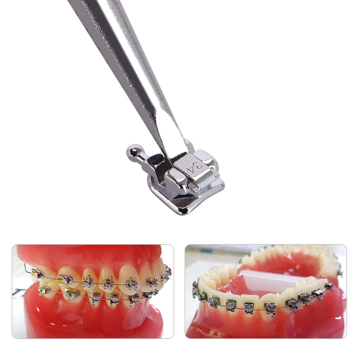 AZDENT 5 กล่องทันตกรรมวงเล็บจัดฟัน Passive Self Ligating MIM Monoblock พร้อม Buccal หลอด MBT/Roth 0.022 345 ตะขอ