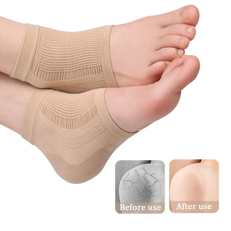 Mesh Gel Silikon Ferse Socken Fuß Abdeckung Feuchtigkeitsspendende Anti-tragen Anti-trocken Rissbildung Halbe Kurze Socken Ferse Abdeckung Pads ferse Schutz