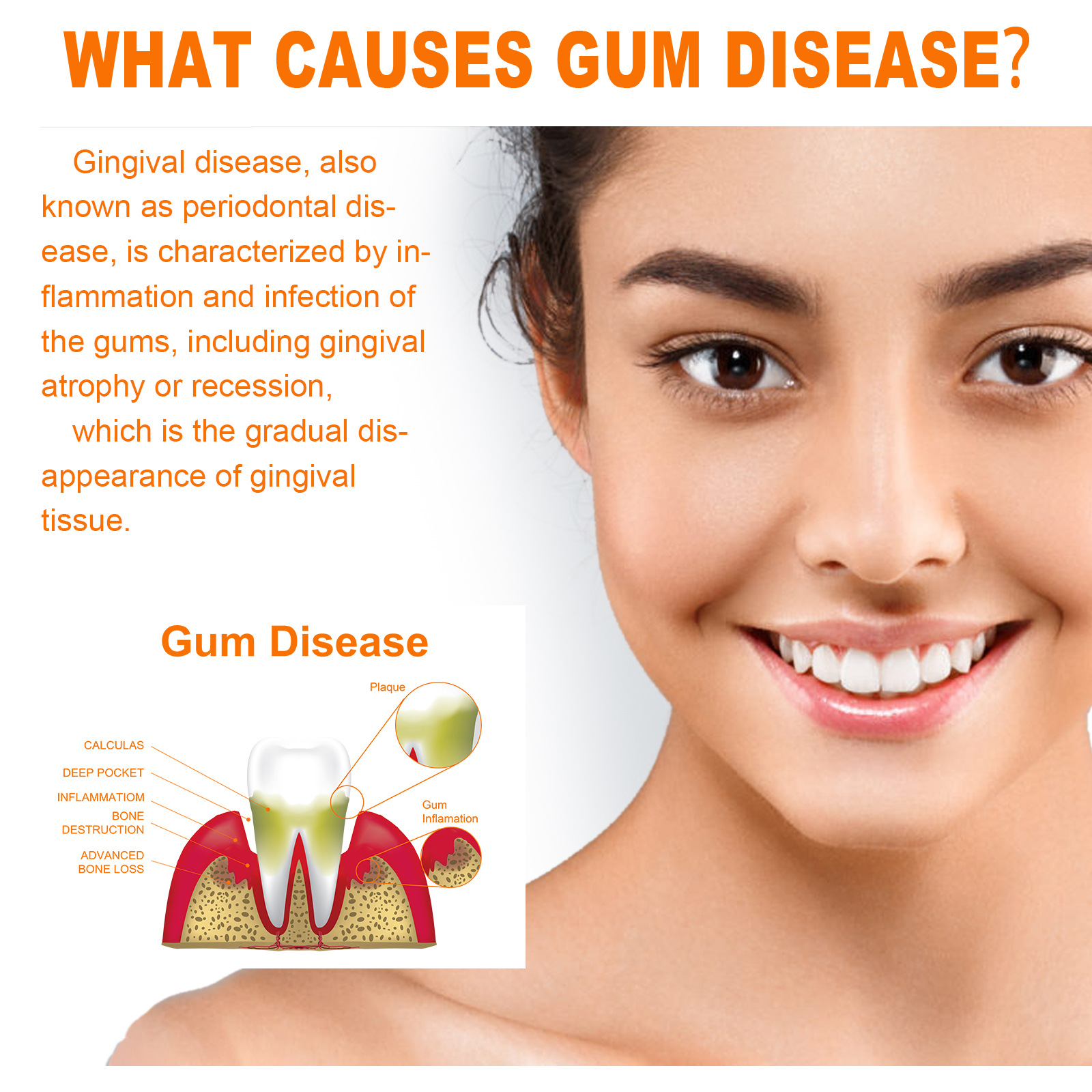 Сыворотка для восстановления десен, капли для облегчения восстановления десен, пародонтальное желтое лечение, фарингит, очистка от боли в полости рта, антибактериальный уход за зубами