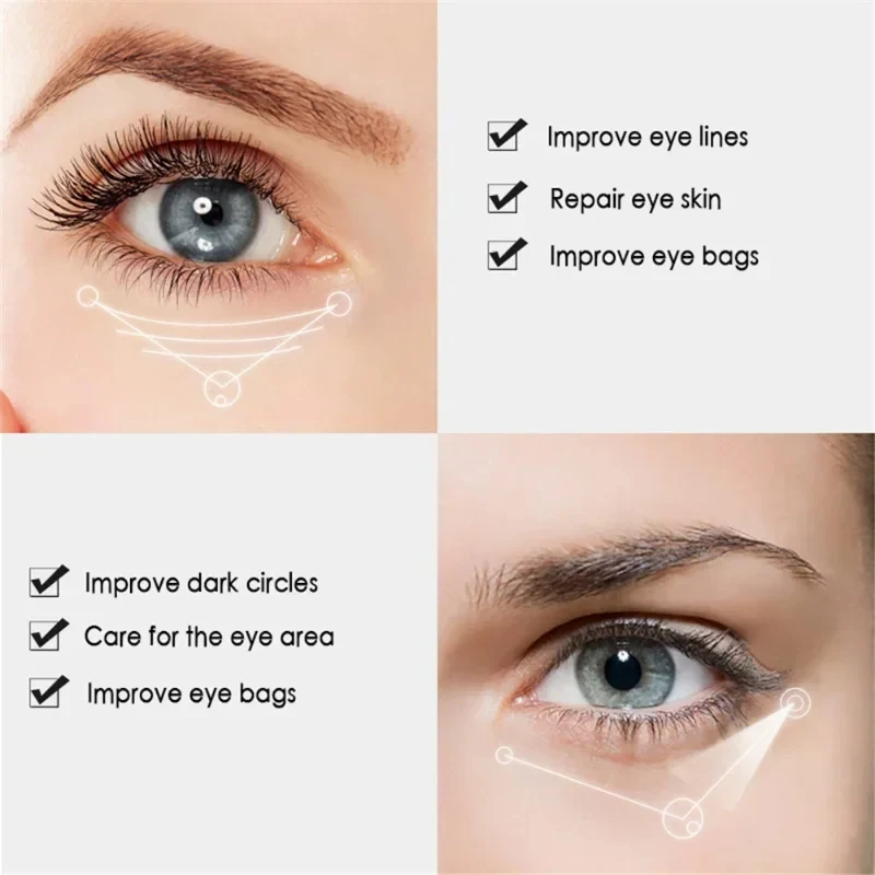 Creme para os olhos com nicotinamida, creme para olheiras, remove bolsas para os olhos, ácido hialurônico, soro hidratante contra inchaço, gel para cuidados com os olhos