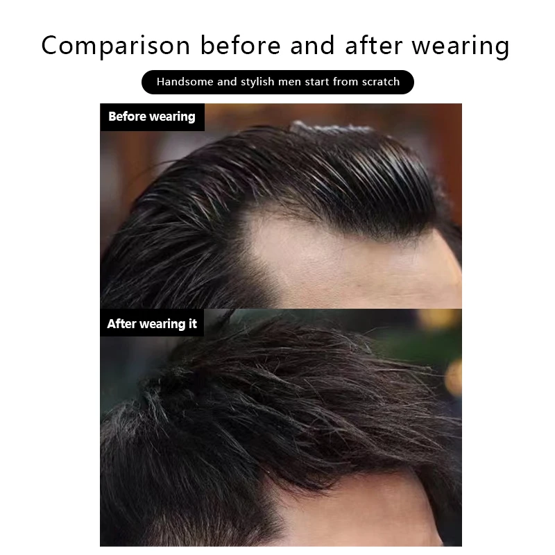 ผมมนุษย์จริงหน้าผาก Patch Hairpiece จอน Toupee ที่มองไม่เห็น Ultra บางผิว PU ผู้ชาย Hairline Sideburn Patch