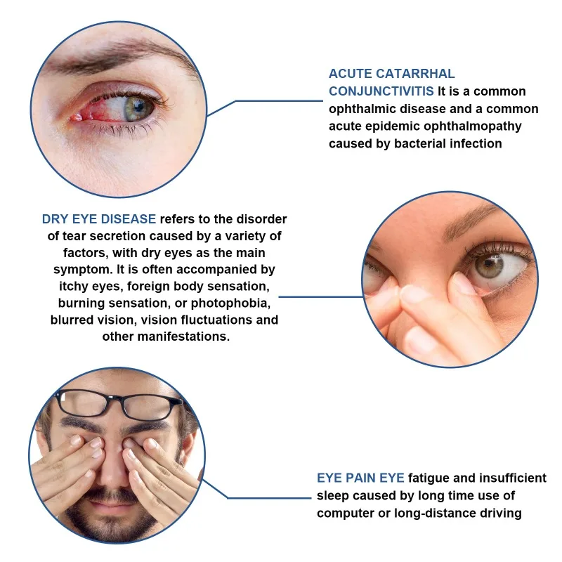 Crema para Ojos que promueve una vista más clara, masaje relajante suave, reduce la incomodidad, alivia la fatiga de los ojos secos, cuidado de la salud ocular