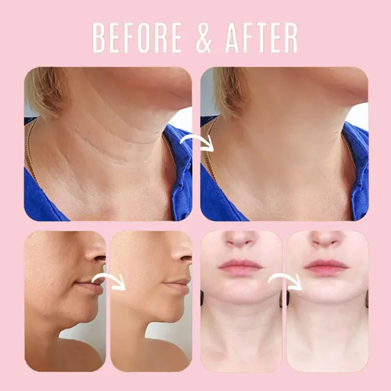 Instant Rimpel Verwijderen Multi Bounce Balsem Gezichtsverstrakking Hydraterende Koreaanse Anti-Rimpel Balsem Stok Crème Huidverzorgingsproducten