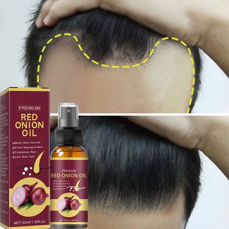 Potente suero para el crecimiento del cabello, Spray para el crecimiento del cabello, tratamiento antipérdida, reparación de esencias, nutre la raíz del cabello para hombres y mujeres, cuidado del cabello