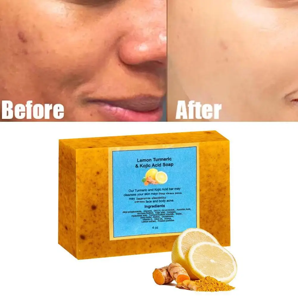 Kurkuma Seife Zitronen seife Koji säure Seife Zitrone & Ingwer handgemachte Körper dusche und Gesichts seife 100g Tiefen reinigung Antioxidans