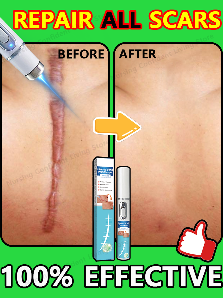 Laser scar repair products