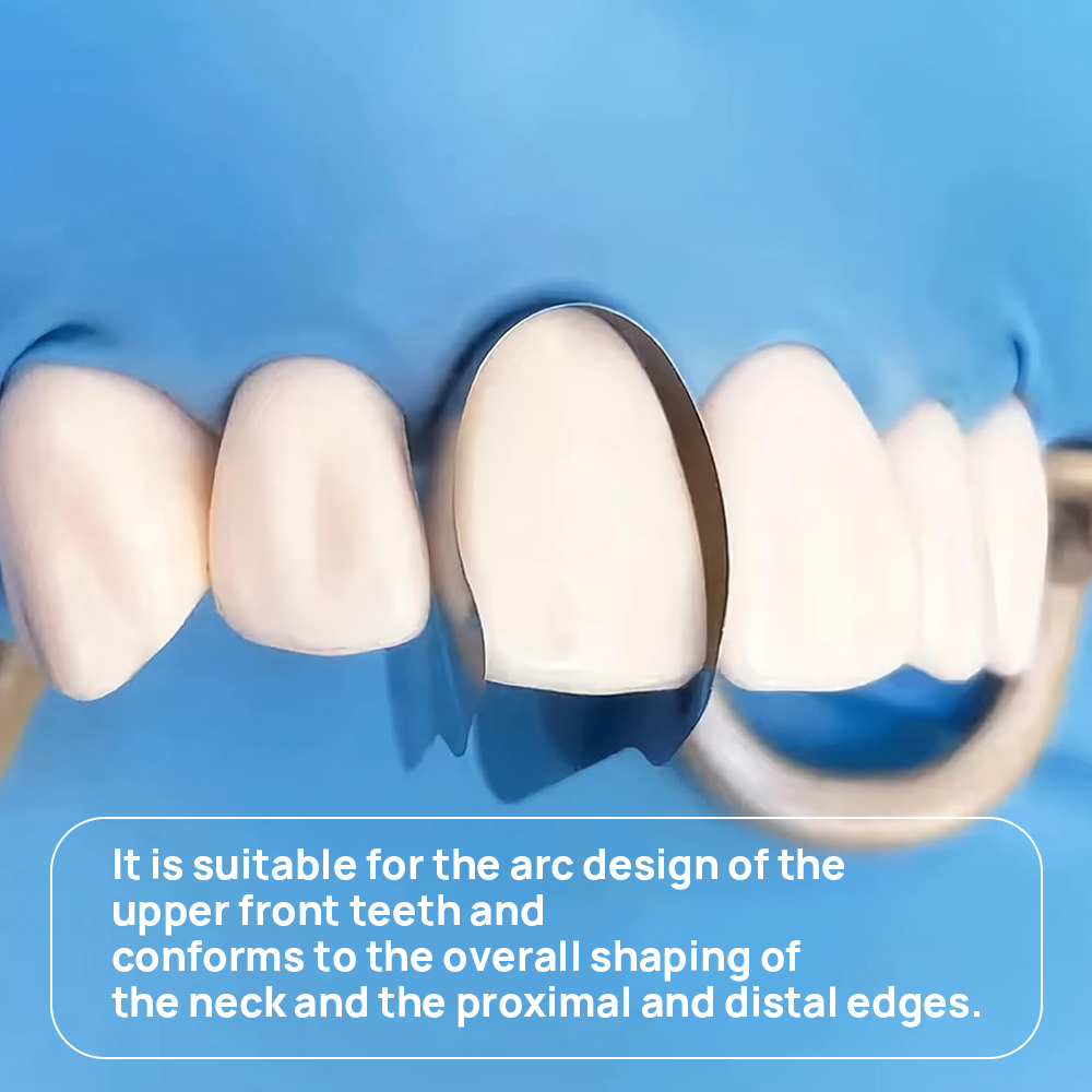 30 Stücke Dental Matrix Konturierte Anterior Metall Matrix Bands Schnittmatrix System Matrizen Zahnmedizin Materialien