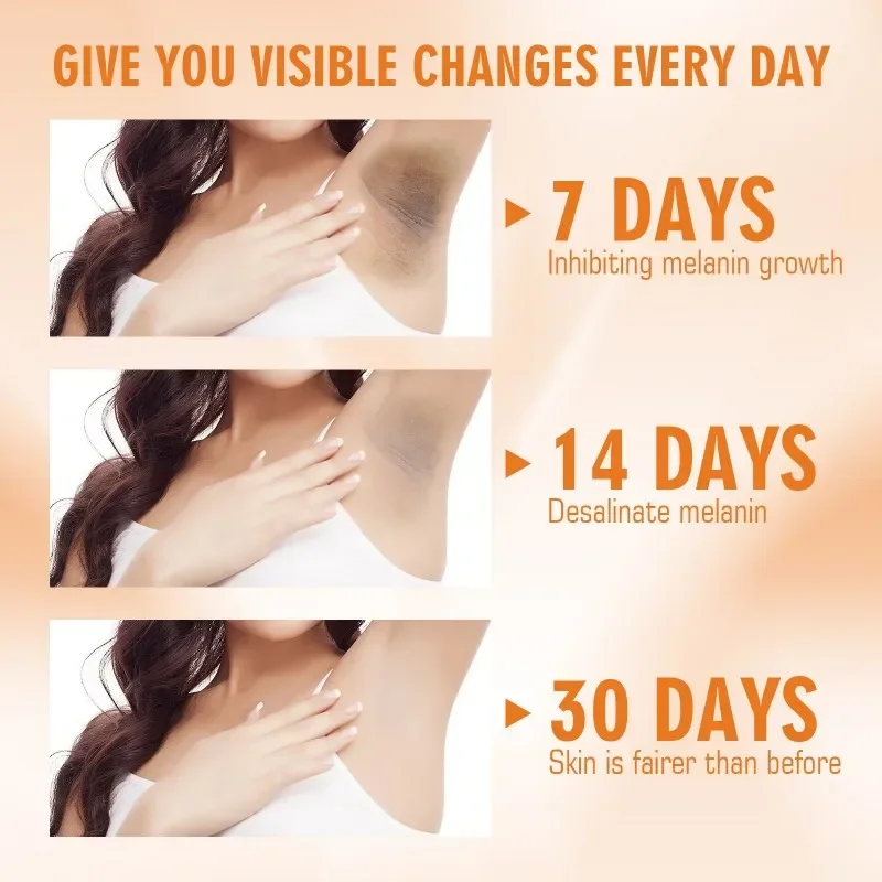 Vitamin C Aufhellende Creme Aufhellende Hautcreme Aufhellendes Melanin Bleichen Achselhöhlen Ellenbogen Knie Feuchtigkeitsspendende Körperlotioncreme