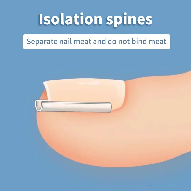 50 pezzi adesivo patch elastico strumento per pedicure strumento per la correzione dell'unghia del piede incarnita trattamento delle unghie incarnite raddrizzamento clip tutore