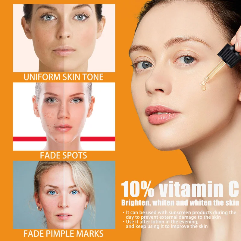Soro de vitamina c para clareamento facial, soro facial com ácido hialurônico, removedor de manchas escuras, produtos coreanos para cuidados com a pele