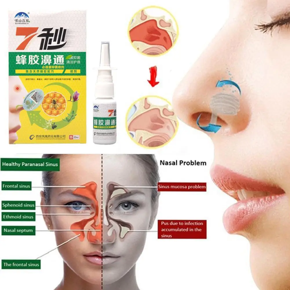 30 unidades de spray para la nariz de 20 ml