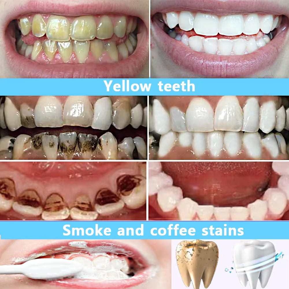 50ml ฟันไวท์เทนนิ่งผงยาสีฟันลบคราบจุลินทรีย์ทําความสะอาดสุขอนามัยช่องปาก Fresh Bad Breath ทันตกรรมฟอกสีเครื่องมือ Care