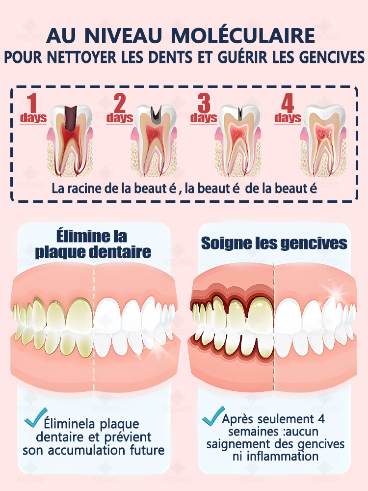 Réparer la carie dentaire, se débarrasser des maux de dents, restaurer et blanchir les dents
